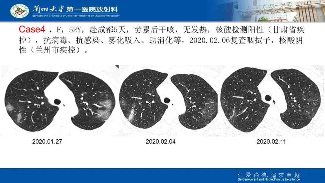 【PPT】新冠肺炎（COVID-19，SARS-CoV2）学习
