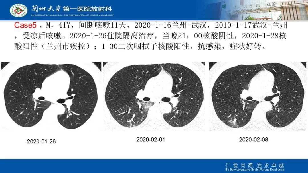 【PPT】新冠肺炎（COVID-19，SARS-CoV2）学习