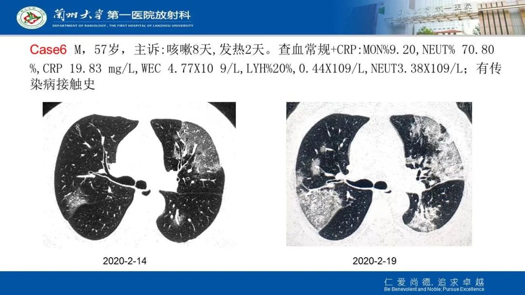 【PPT】新冠肺炎（COVID-19，SARS-CoV2）学习