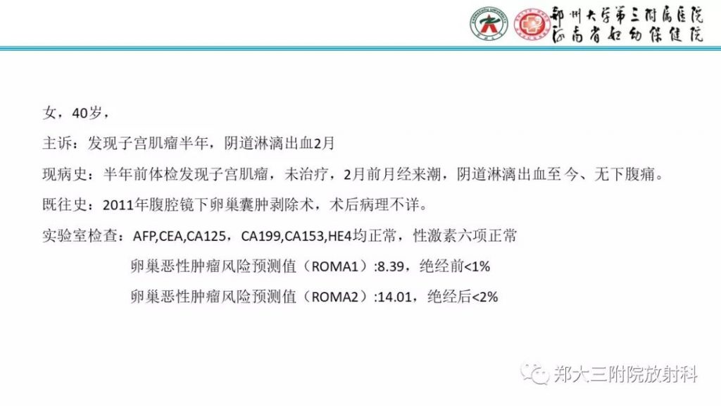 【病例】卵巢颗粒细胞瘤1例MR影像