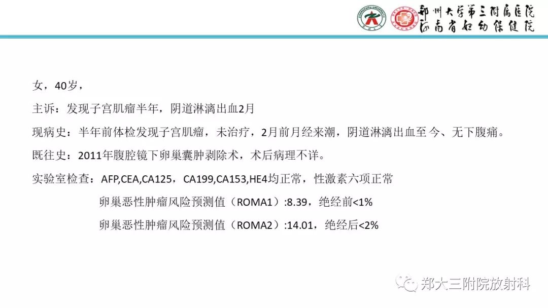 【病例】卵巢颗粒细胞瘤1例MR影像