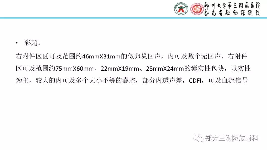 【病例】卵巢颗粒细胞瘤1例MR影像
