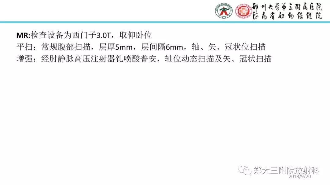【病例】卵巢颗粒细胞瘤1例MR影像