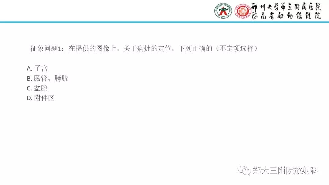 【病例】卵巢颗粒细胞瘤1例MR影像