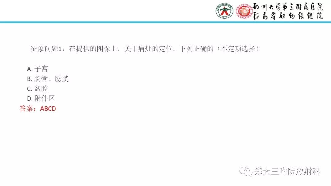 【病例】卵巢颗粒细胞瘤1例MR影像