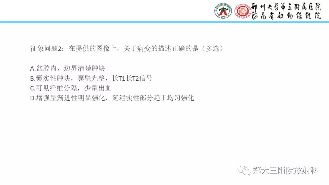 【病例】卵巢颗粒细胞瘤1例MR影像