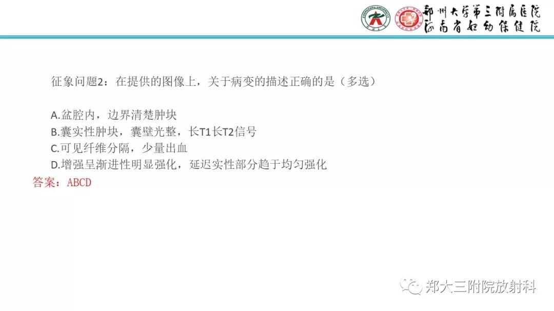 【病例】卵巢颗粒细胞瘤1例MR影像