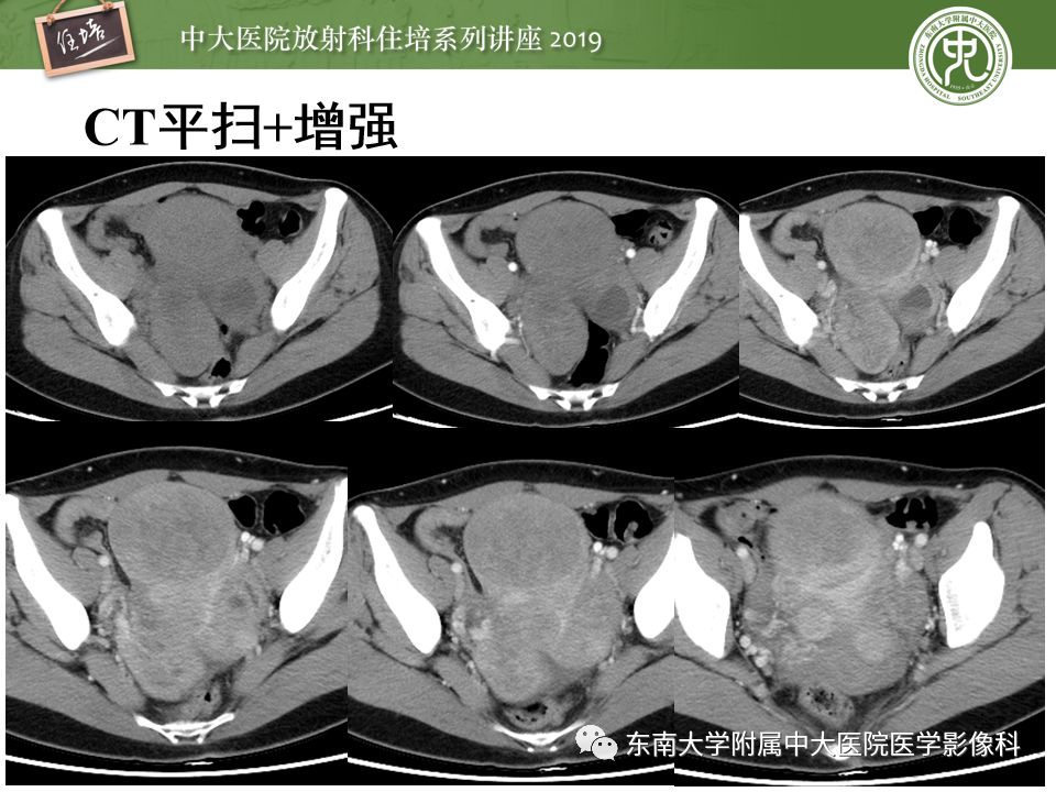 【PPT】“剑走偏锋”——胃肠道恶性肿瘤