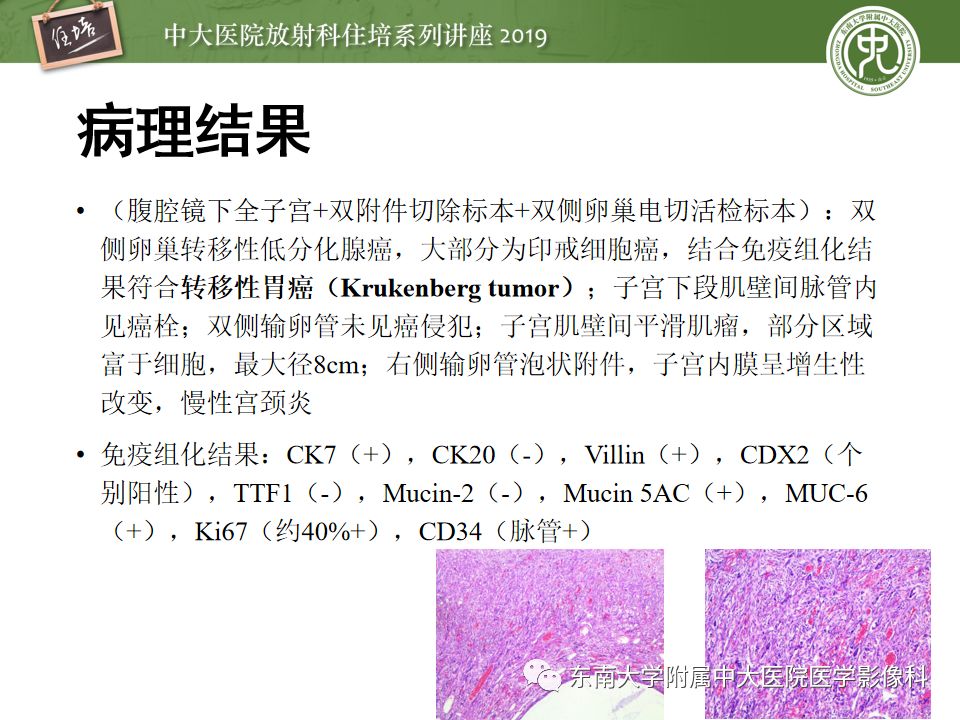 【PPT】“剑走偏锋”——胃肠道恶性肿瘤