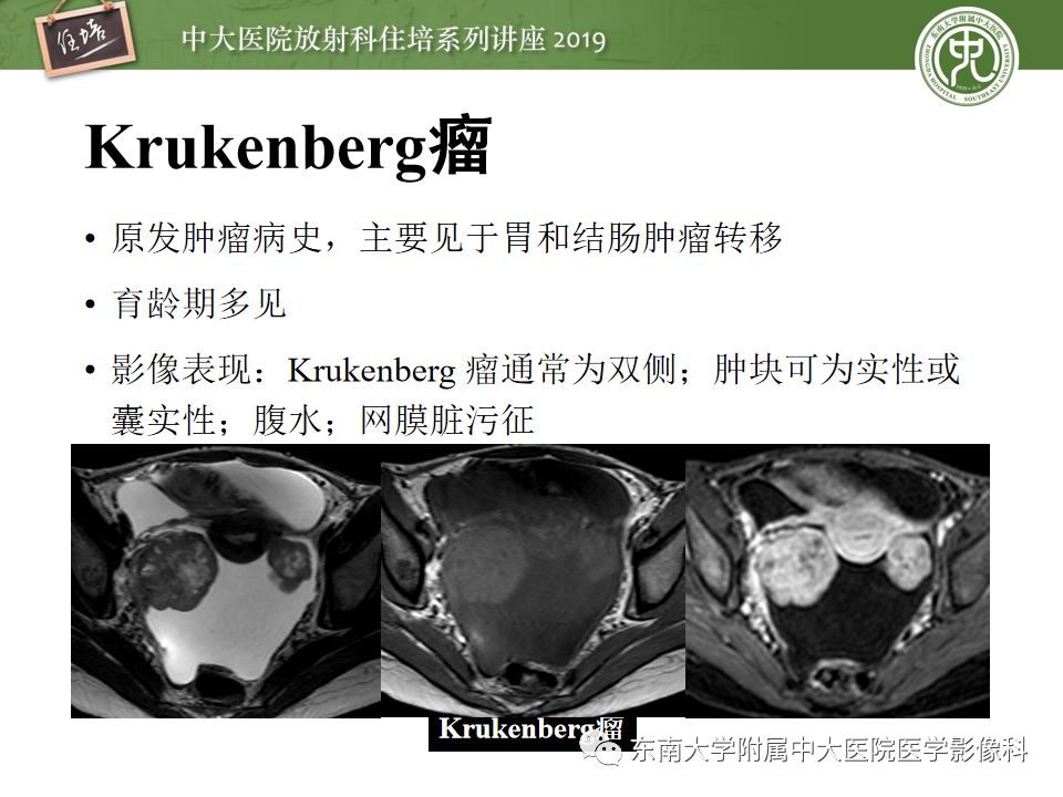 【PPT】“剑走偏锋”——胃肠道恶性肿瘤