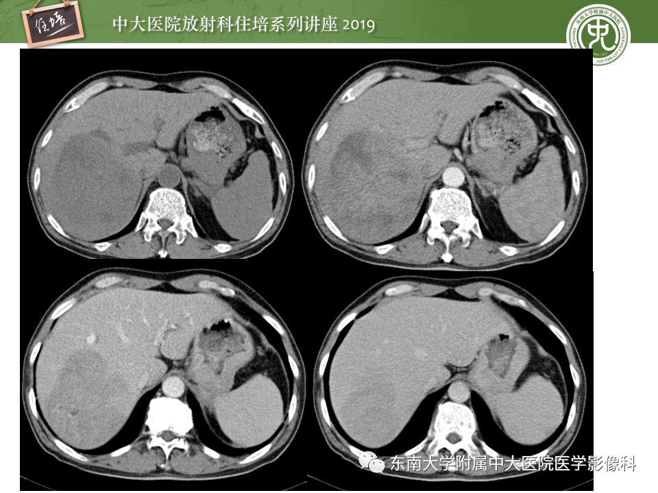 【PPT】“剑走偏锋”——胃肠道恶性肿瘤