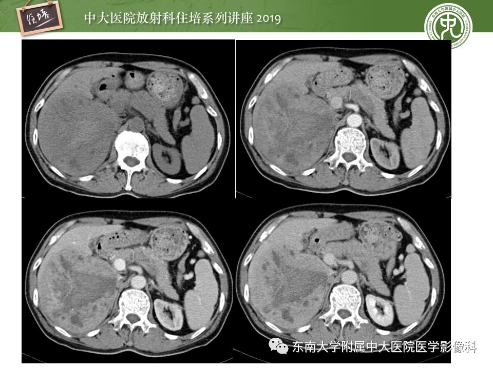 【PPT】“剑走偏锋”——胃肠道恶性肿瘤