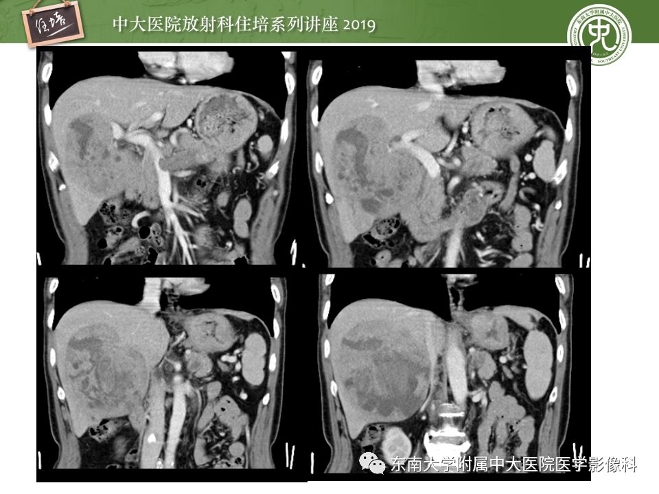 【PPT】“剑走偏锋”——胃肠道恶性肿瘤