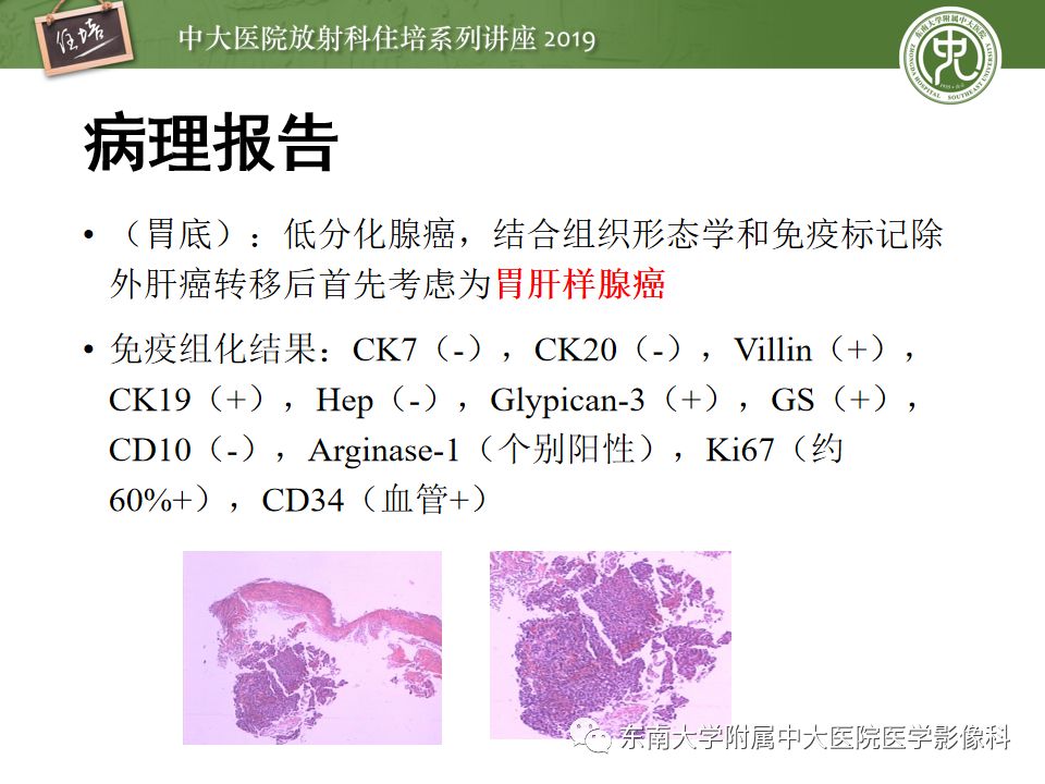 【PPT】“剑走偏锋”——胃肠道恶性肿瘤