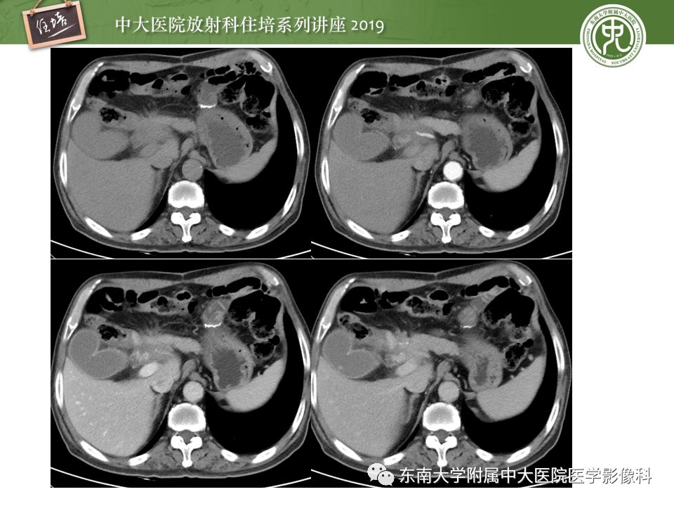 【PPT】“剑走偏锋”——胃肠道恶性肿瘤