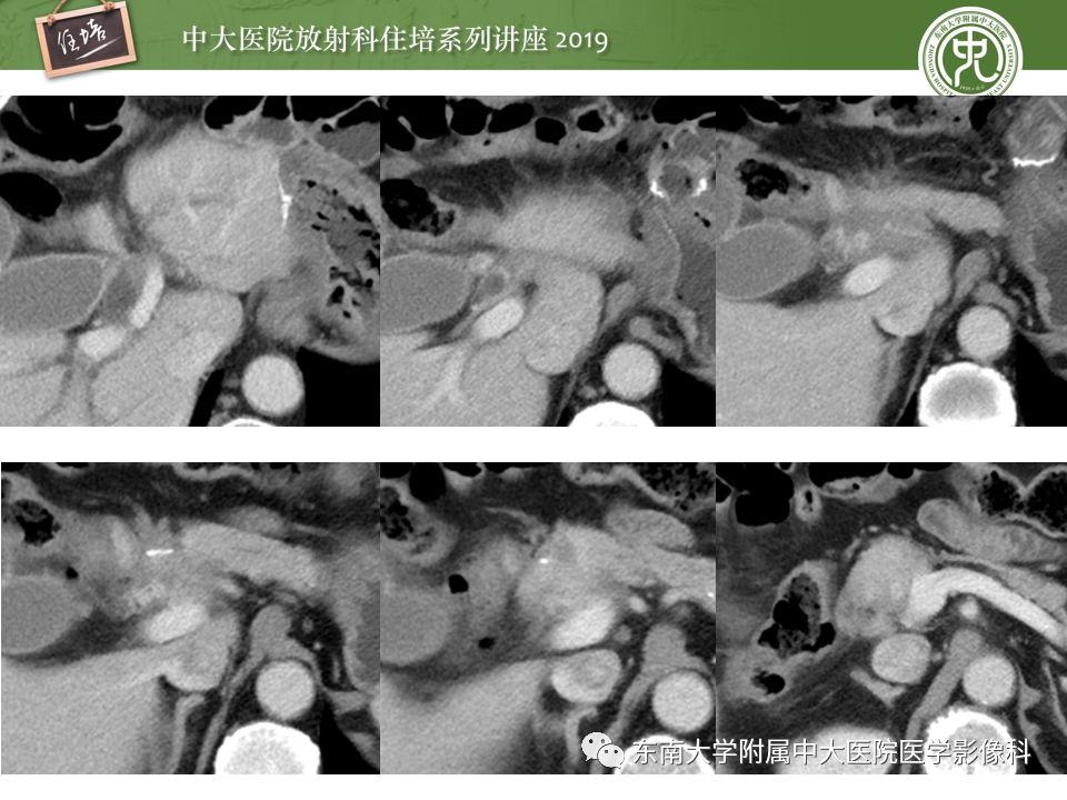 【PPT】“剑走偏锋”——胃肠道恶性肿瘤