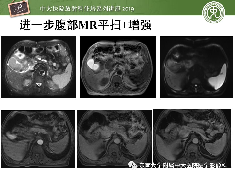 【PPT】“剑走偏锋”——胃肠道恶性肿瘤