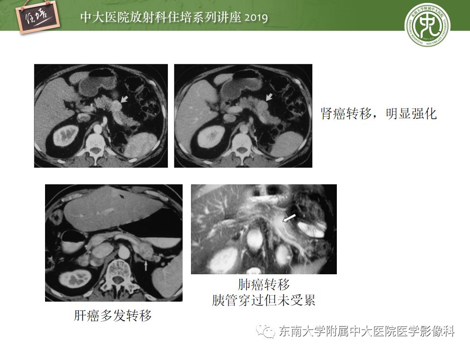 【PPT】“剑走偏锋”——胃肠道恶性肿瘤