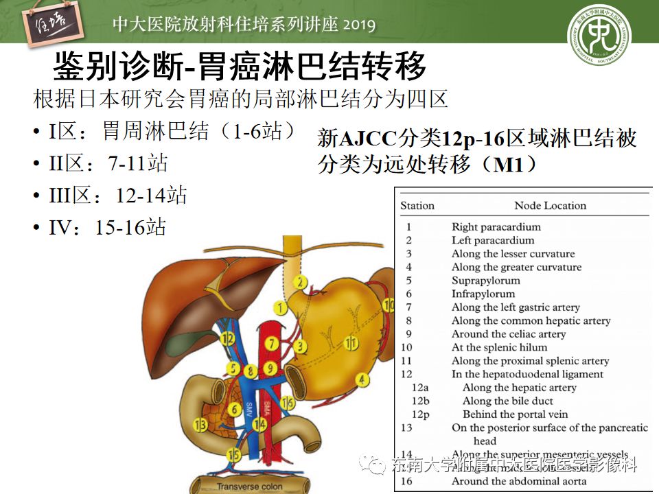 【PPT】“剑走偏锋”——胃肠道恶性肿瘤