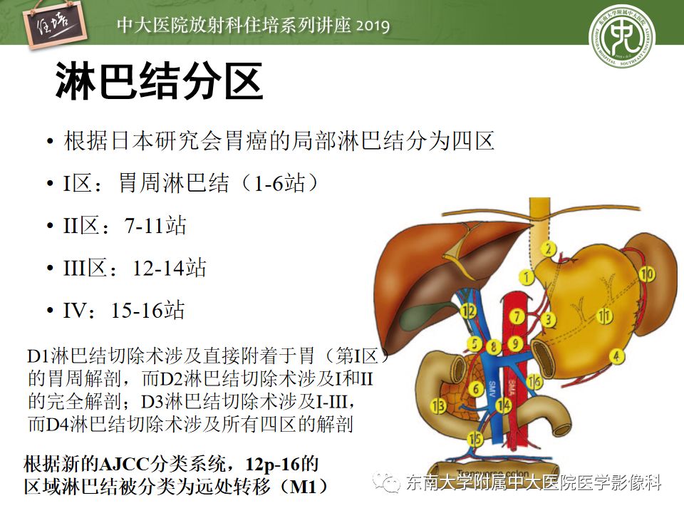 【PPT】“剑走偏锋”——胃肠道恶性肿瘤