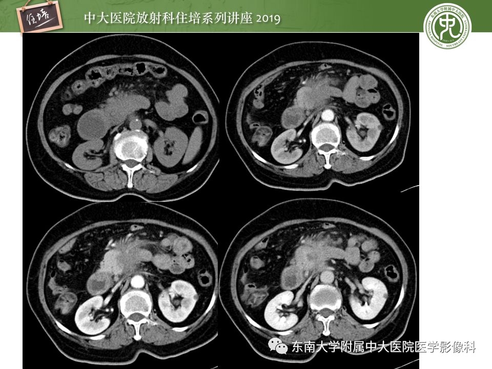 【PPT】“剑走偏锋”——胃肠道恶性肿瘤