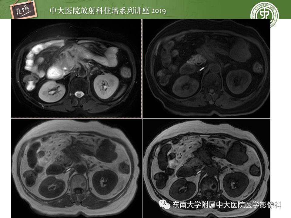 【PPT】“剑走偏锋”——胃肠道恶性肿瘤