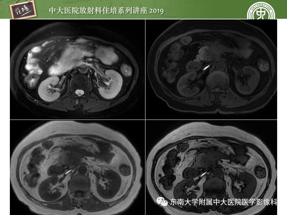 【PPT】“剑走偏锋”——胃肠道恶性肿瘤