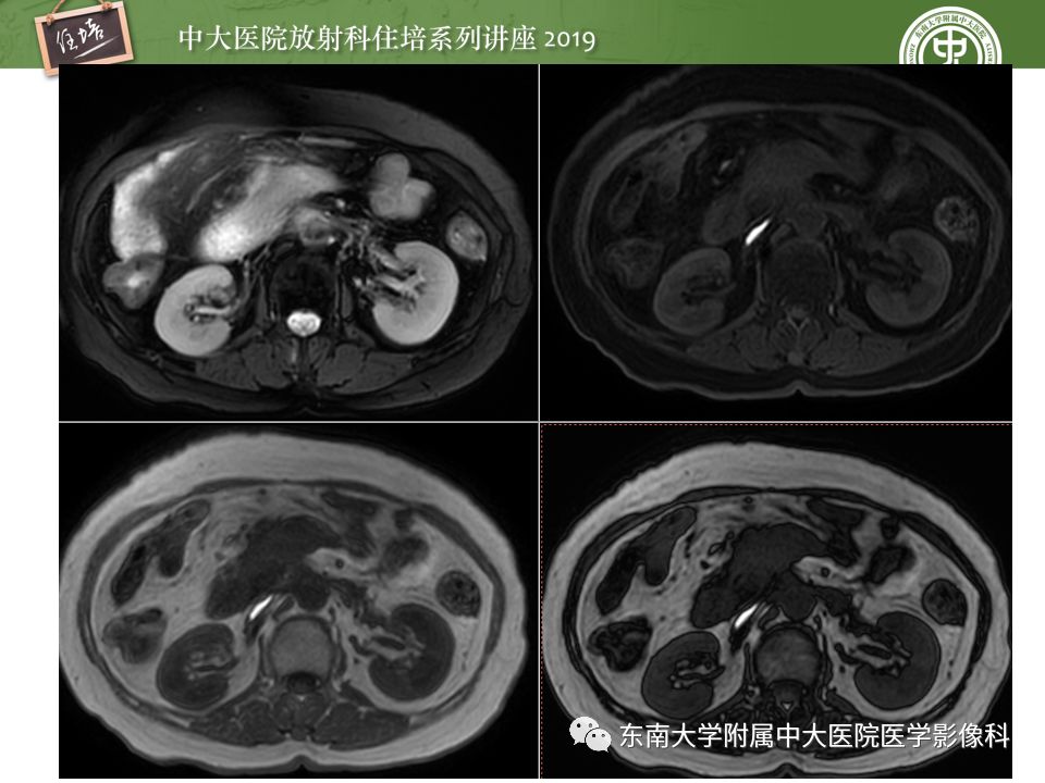 【PPT】“剑走偏锋”——胃肠道恶性肿瘤