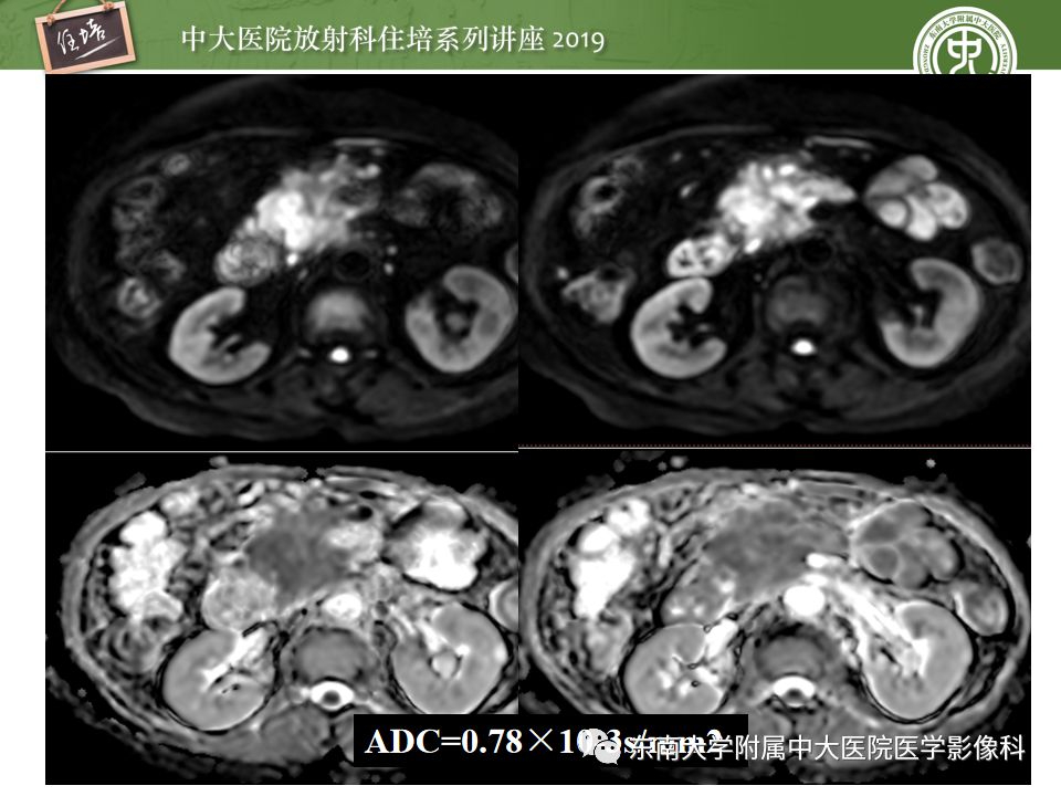【PPT】“剑走偏锋”——胃肠道恶性肿瘤