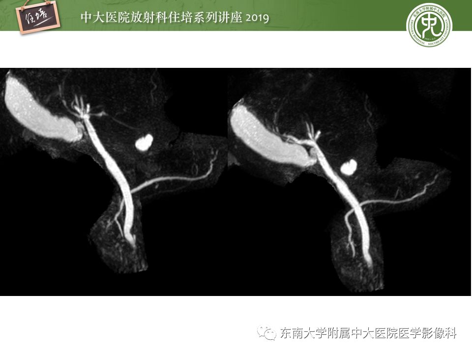【PPT】“剑走偏锋”——胃肠道恶性肿瘤