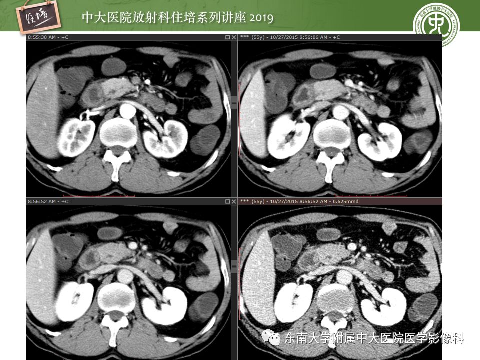【PPT】“剑走偏锋”——胃肠道恶性肿瘤