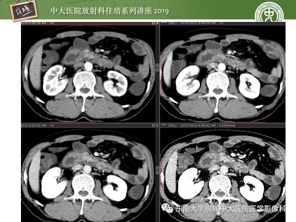 【PPT】“剑走偏锋”——胃肠道恶性肿瘤