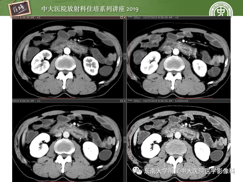 【PPT】“剑走偏锋”——胃肠道恶性肿瘤