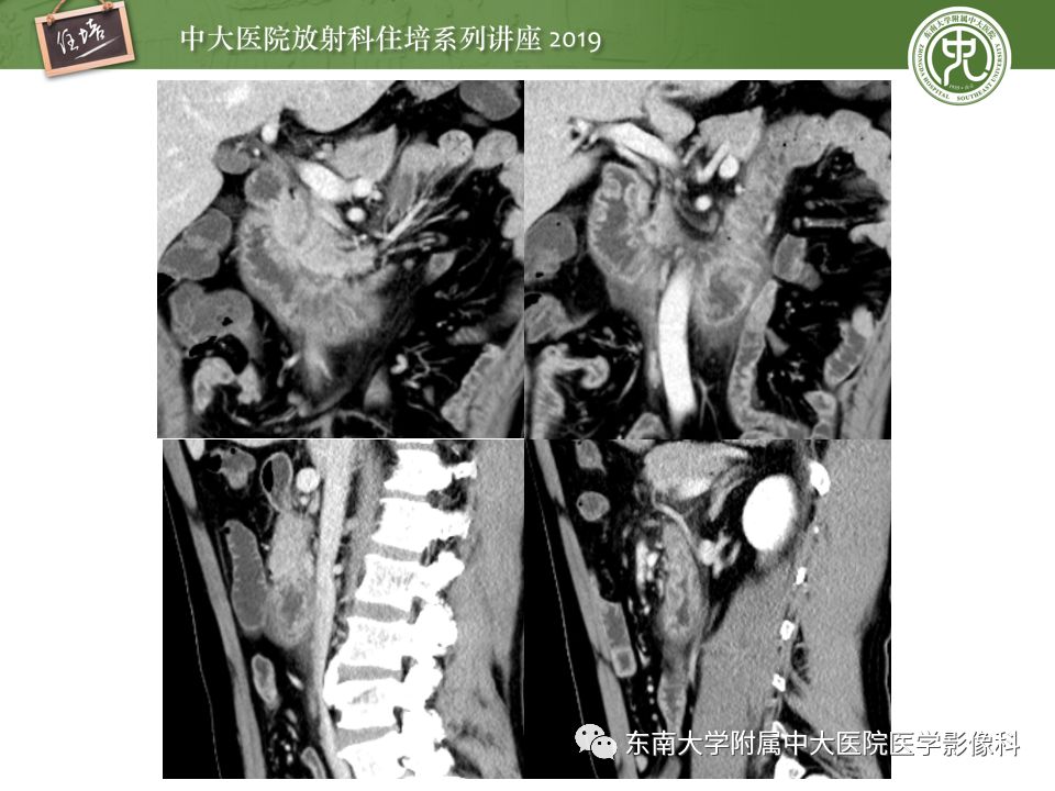 【PPT】“剑走偏锋”——胃肠道恶性肿瘤
