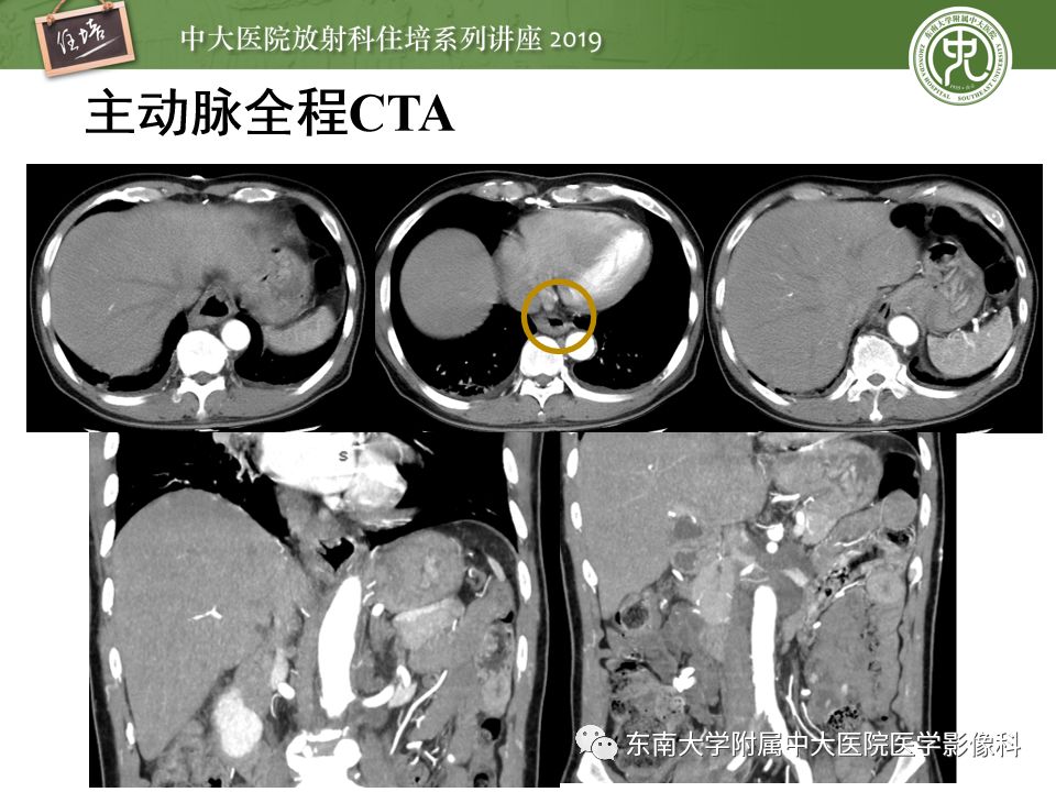 【PPT】“剑走偏锋”——胃肠道恶性肿瘤
