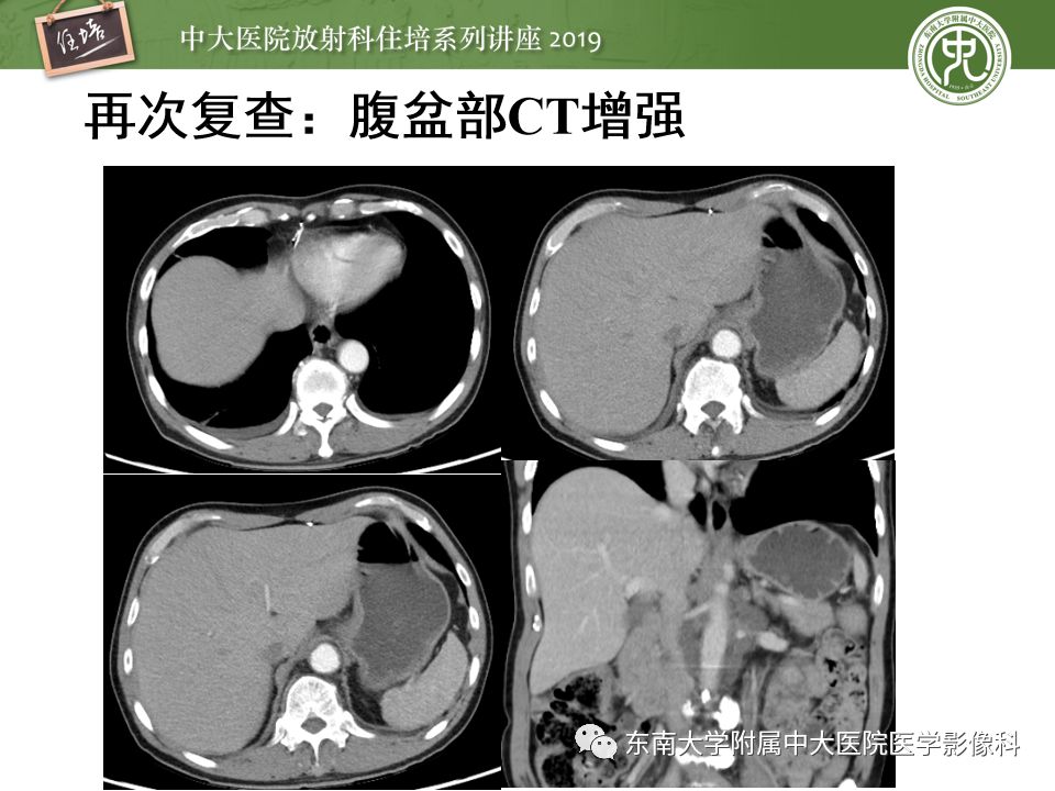 【PPT】“剑走偏锋”——胃肠道恶性肿瘤
