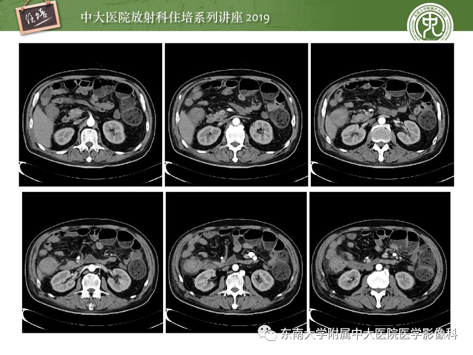 【PPT】“剑走偏锋”——胃肠道恶性肿瘤