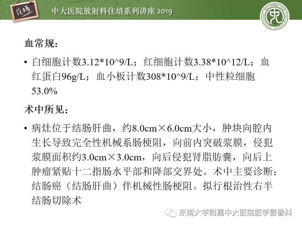 【PPT】“剑走偏锋”——胃肠道恶性肿瘤