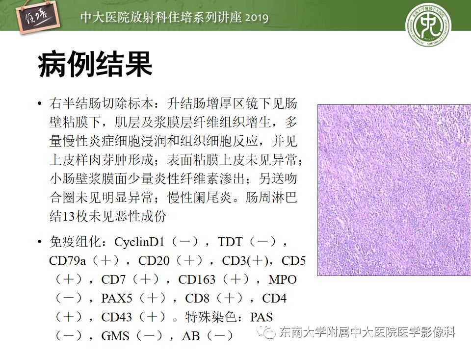 【PPT】“剑走偏锋”——胃肠道恶性肿瘤