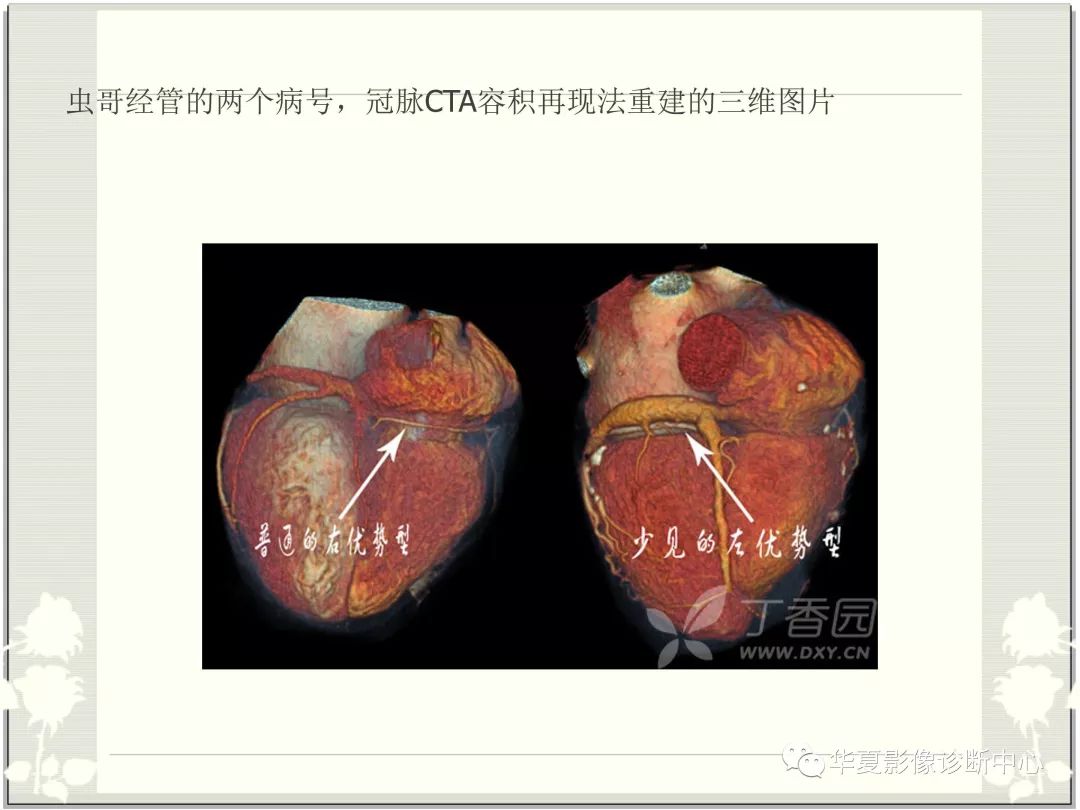 【PPT】心脏血管的解剖