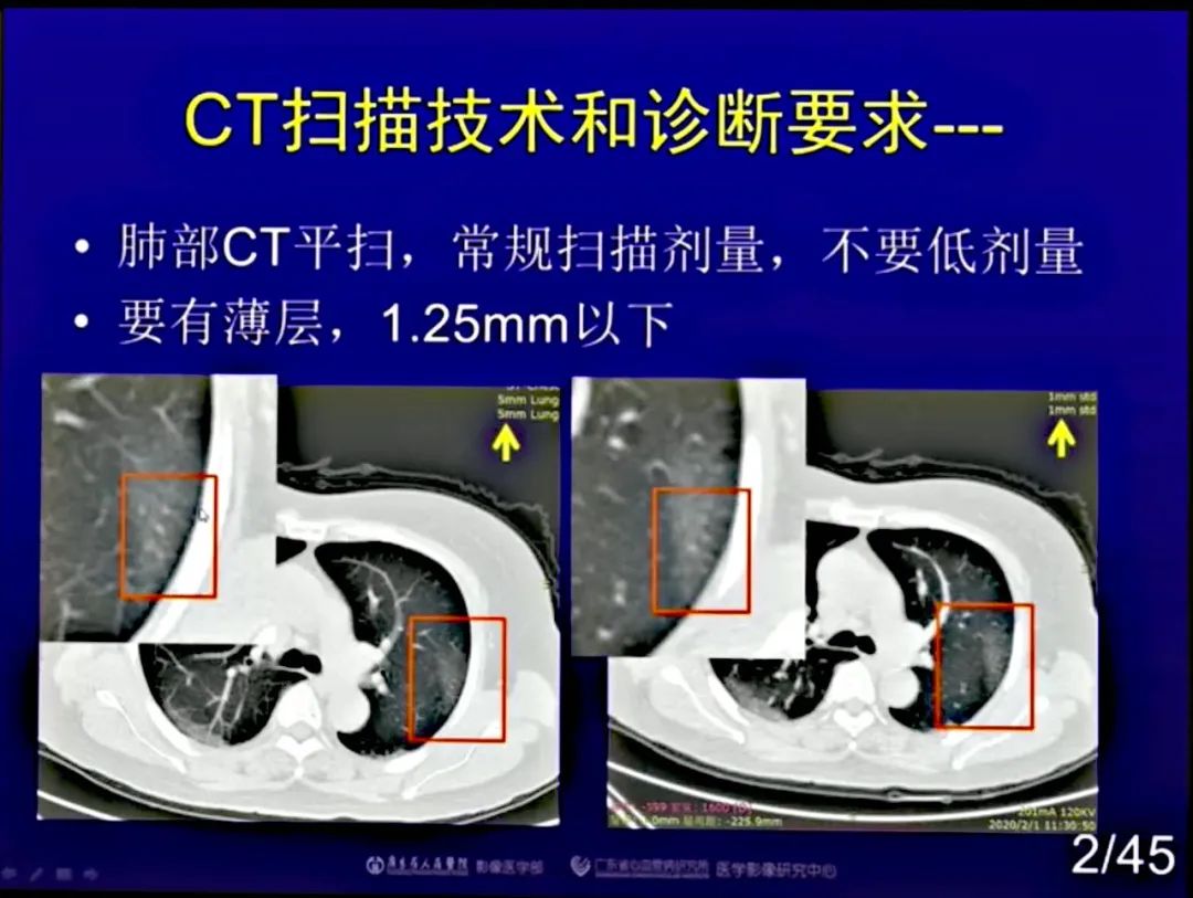 【PPT】新型冠状病毒感染CT早期诊断和鉴别诊断