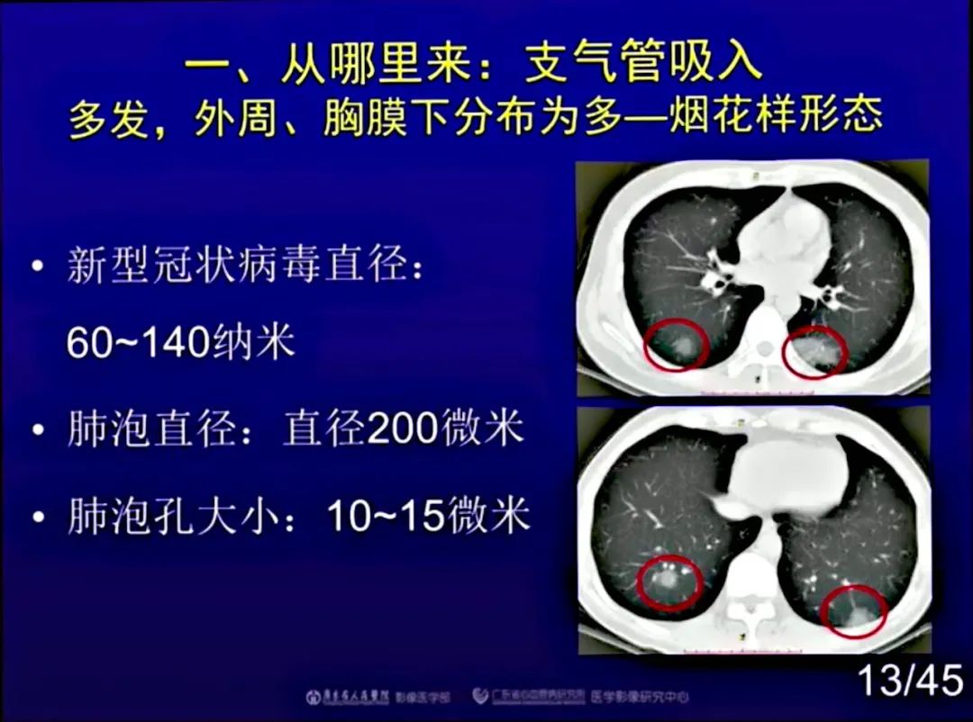 【PPT】新型冠状病毒感染CT早期诊断和鉴别诊断