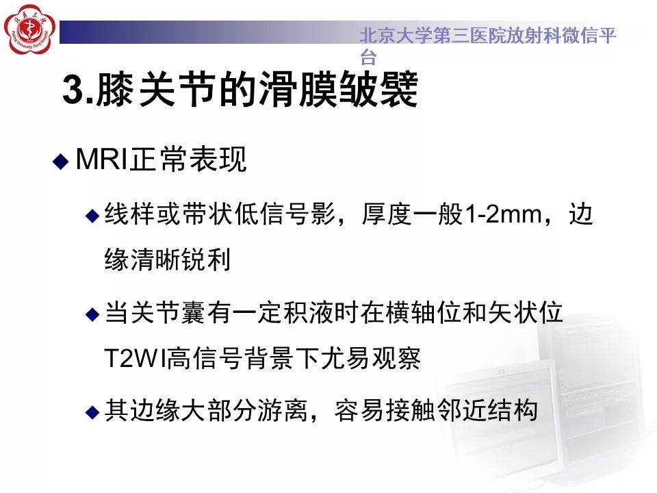 【PPT】髌股关节内侧滑膜皱襞综合征