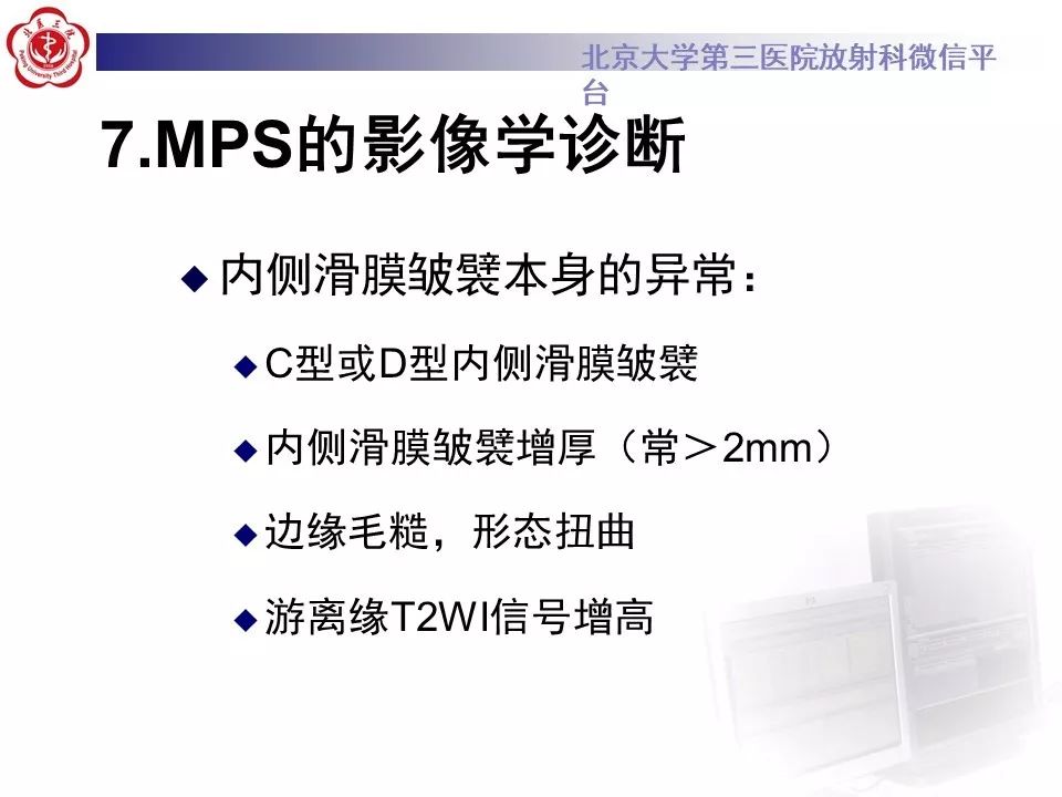 【PPT】髌股关节内侧滑膜皱襞综合征