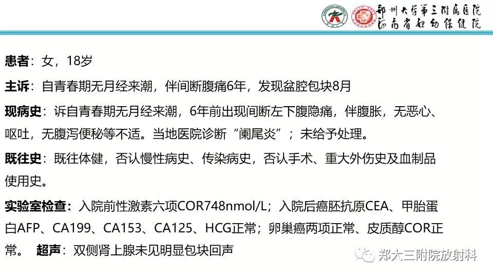 【病例】卵巢无性细胞瘤1例MR影像