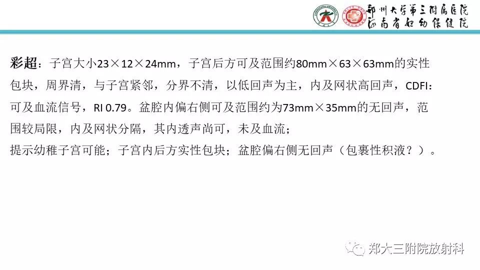 【病例】卵巢无性细胞瘤1例MR影像