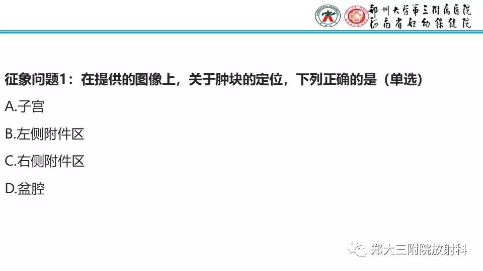 【病例】卵巢无性细胞瘤1例MR影像