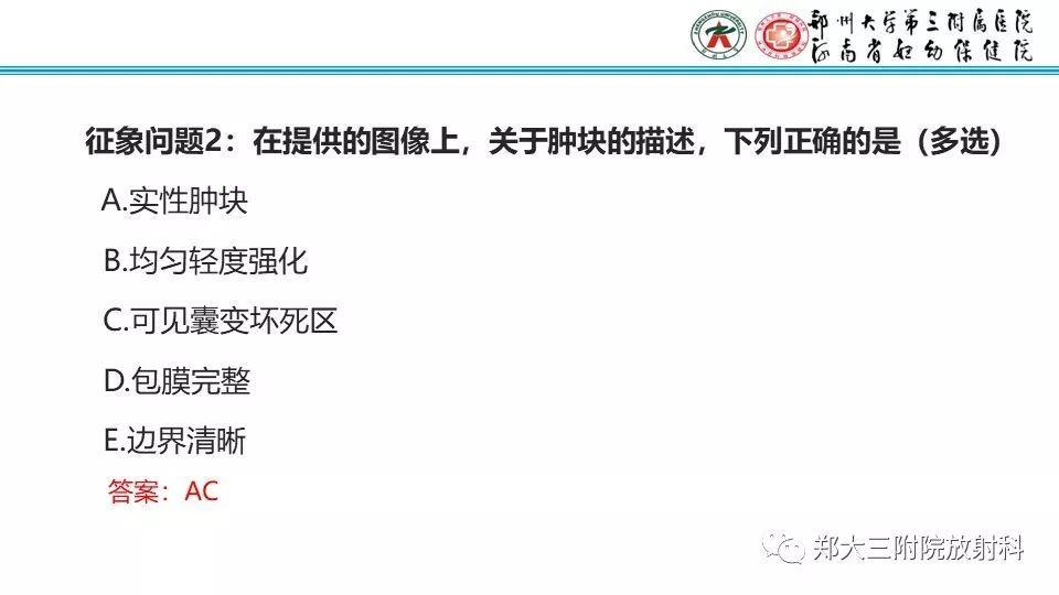 【病例】卵巢无性细胞瘤1例MR影像
