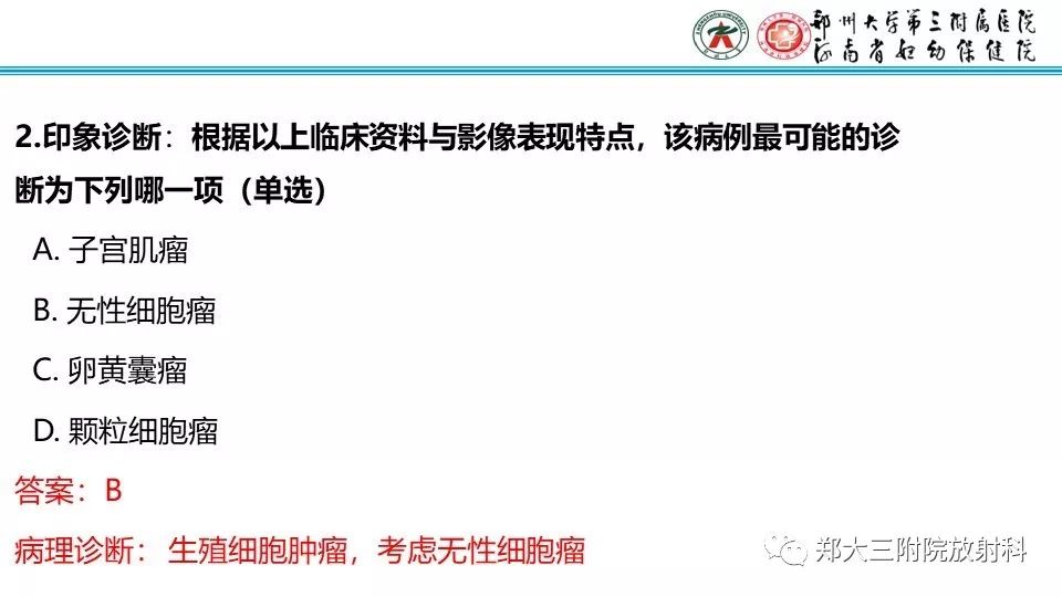 【病例】卵巢无性细胞瘤1例MR影像
