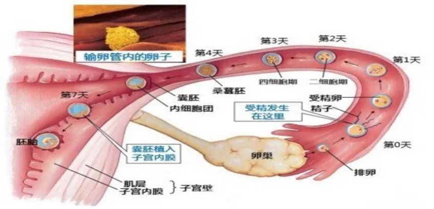 女性盆腔附件解剖及其常见肿瘤的影像表现 女性盆腔附件解剖及其常见肿瘤的影像表现